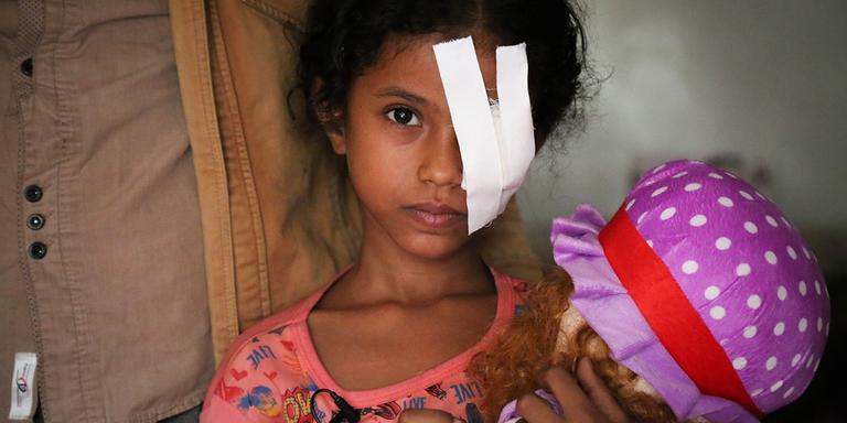 In Yemen, a girl wears a white bandage covering her wounded eye and holds a doll in her hands. In Yemen, a girl wears a white bandage covering her wounded eye and holds a doll in her hands.